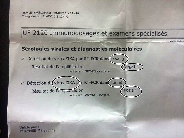 EXCLUSIVO: “Nunca saí de Oiapoque”, diz 1ª paciente com zika no AP