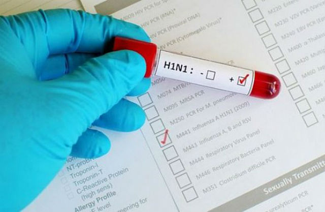 SVS confirma morte pelo H1N1 no Amapá
