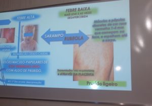 Fiocruz confirma 1º caso de sarampo no Amapá