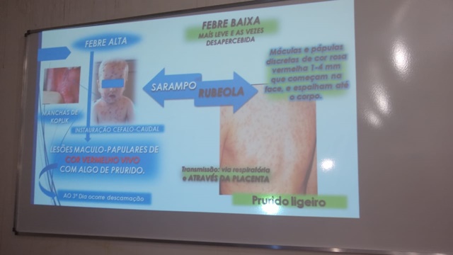 Fiocruz confirma 1º caso de sarampo no Amapá