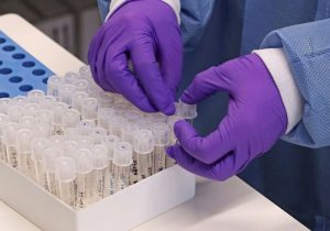 Amapá tem mais de 370 casos de coronavírus; 10 estão em UTI