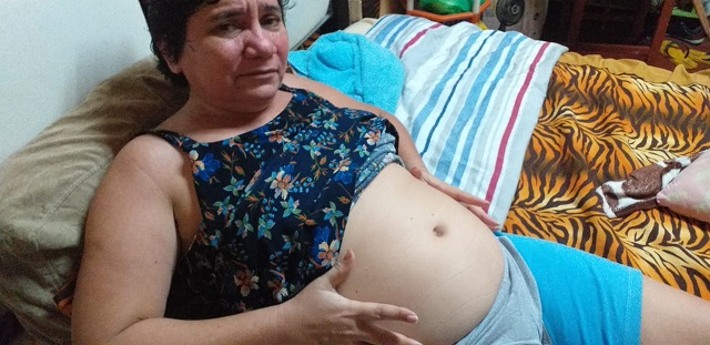 Com fortes dores, professora com câncer busca tratamento fora do Amapá