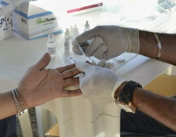 Apesar de ‘isolamento’, casos de HIV disparam no Amapá