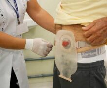 Vereadores aprovam lei que reconhece direitos de pessoas ostomizadas