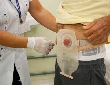 Vereadores aprovam lei que reconhece direitos de pessoas ostomizadas