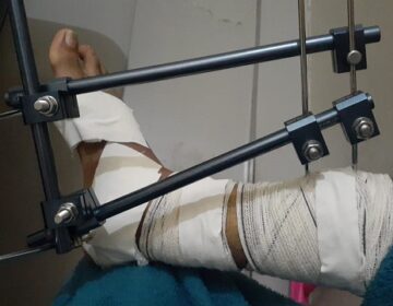 Comerciante leva tiros ao defender filhas de assalto e aguarda cirurgia