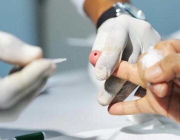 OuvirPodcast: O perigo das hepatites virais