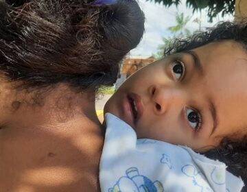 Sofrendo convulsões diárias, menino com hidrocefalia precisa de ajuda para viver