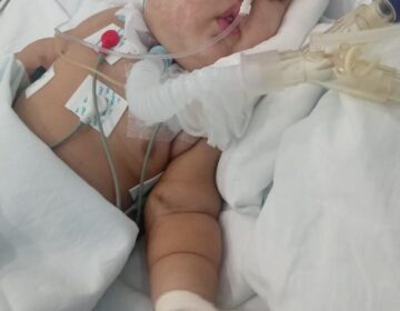 Família luta para salvar bebê com apenas um pulmão funcionando