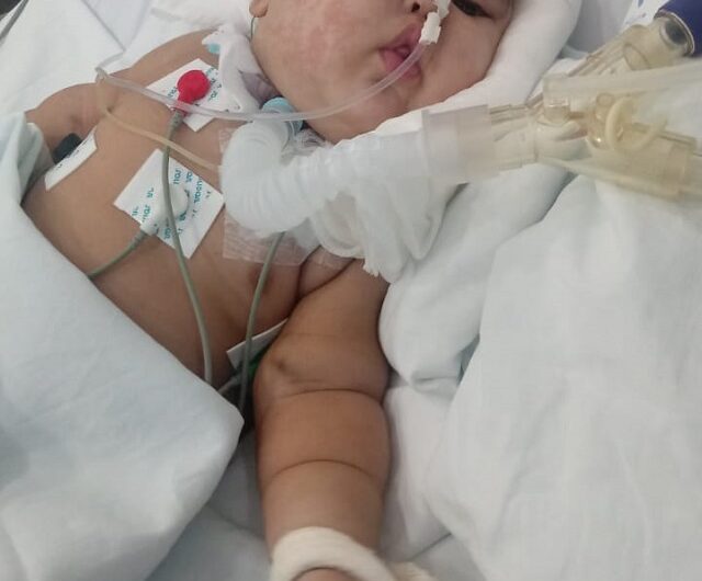 Família luta para salvar bebê com apenas um pulmão funcionando