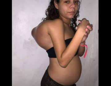 Grávida e com câncer raro, jovem luta para sobreviver e salvar o filho