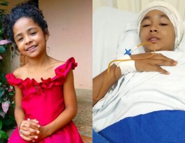 Escalpelada, menina de 10 anos precisa de apoio para reconstruir couro cabeludo