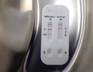 Autotestes: Após aprovação pela Anvisa, farmácias do Amapá se preparam para comercialização