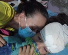 Menina de 11 anos leva 100 pontos na cabeça após ser atropelada; condutor fugiu do local