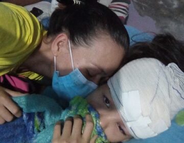 Menina de 11 anos leva 100 pontos na cabeça após ser atropelada; condutor fugiu do local