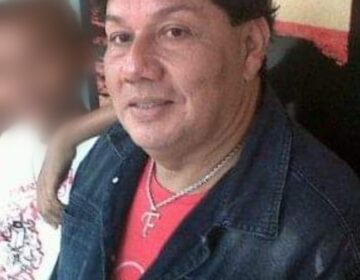 Com cirrose, Fancywaldo Lenno espera por transplante de fígado