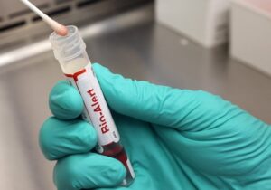 UW Medicine Virology Lab Tests For Monkeypox Virus