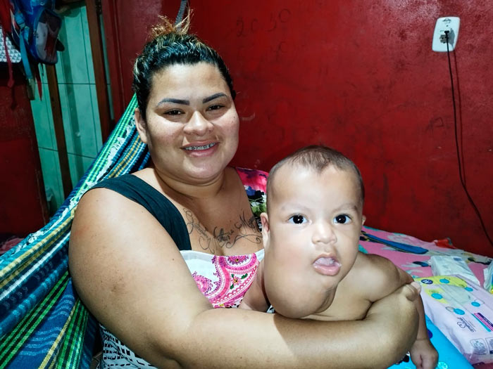 Bebê recebe R$ 20 mil em doações e tem cirurgia marcada: ‘anjos em nossas vidas’
