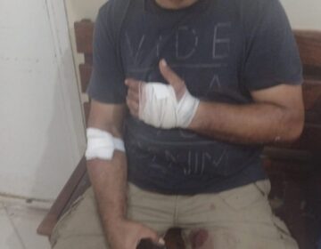 Policial aposentado é esfaqueado, mas impede assalto em restaurante