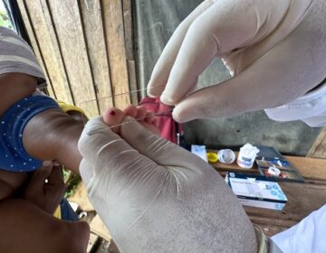 Malária: após aumento de 70%, União reconhece emergência em 7 cidades do AP
