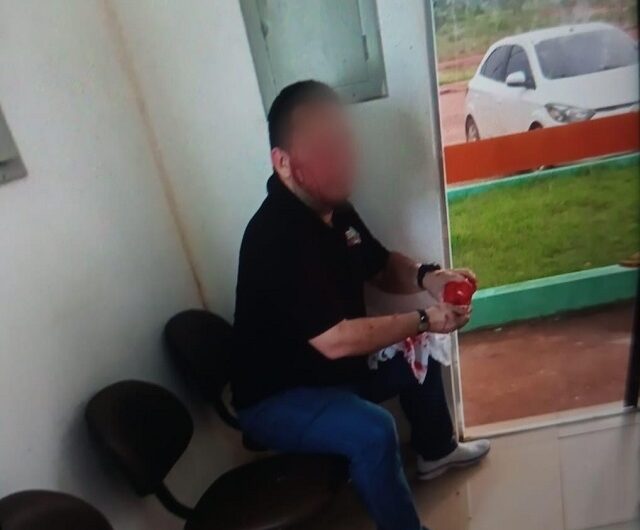 Servidor esfaqueou secretário por ciúmes da esposa, diz polícia