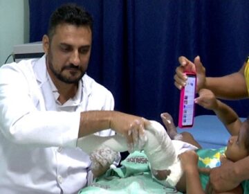 ONG que trata crianças com pé torto luta por órteses para pacientes