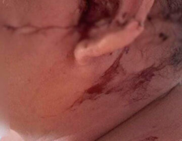 Golpeada com terçado, mulher é lavada e estuprada pelo ex-companheiro