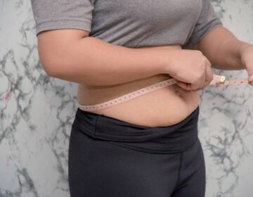 Lipoaspiração ou abdominoplastia?