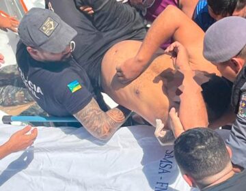 Policial Civil é baleado no sul do Amapá