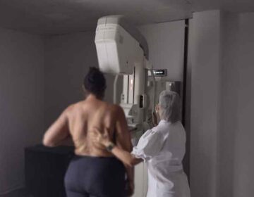 Mutirão busca aumentar cobertura de mamografias, que é de 40% apenas