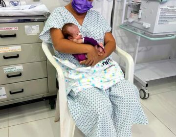 ‘Língua presa’: bebês que passaram por cirurgia terão terapia na Maternidade Mãe Luzia