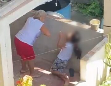 Criança agredida por avó está sob cuidados da tia, diz Conselho Tutelar