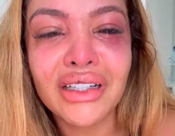 Influencer afirma ter sido espancada por ex-namorado durante jantar
