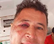 Morre locutor agredido por não “dar R$ 2” a criminoso