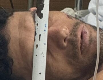 Foragido sente dores e é preso ao ser reconhecido em hospital