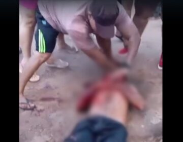 PM de folga se arrisca e salva a vida de homem esfaqueado no pescoço