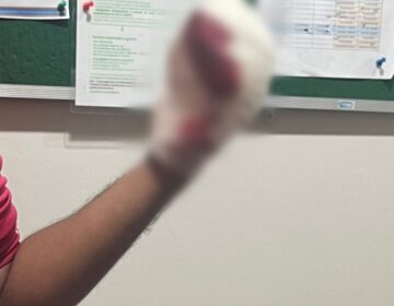 Dono de açougue que estourou dedo de funcionário por causa de dívida trabalhista é preso