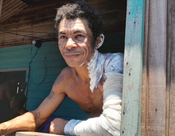 “Me queimava de novo”, diz morador que ajudou a salvar crianças em incêndio