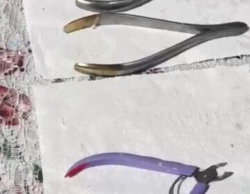 Dentista clandestino usava alicate de unha em atendimentos