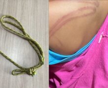 Menina de 5 anos pede ajuda da mãe para fazer dever de casa e é espancada com corda, diz polícia