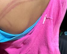 Mãe que espancou filha por pedido de ajuda no dever de casa é solta pela Justiça
