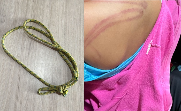 Menina de 5 anos pede ajuda da mãe para fazer dever de casa e é espancada com corda, diz polícia