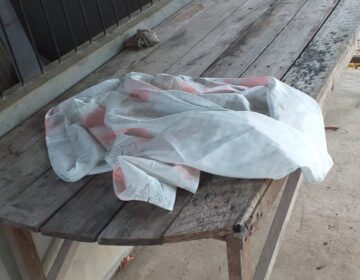 Recém-nascida é abandonada ensanguentada sobre mesa no interior do Amapá