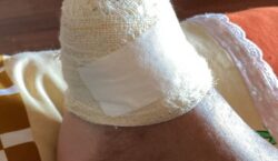 Sargento da PM é condenado por tiros que amputaram perna e pé de vítimas em Santana