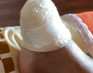 Sargento da PM é condenado por tiros que amputaram perna e pé de vítimas em Santana