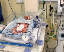 Tratamento que resfria o corpo para proteger o cérebro é aplicado em bebê no Amapá