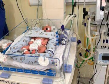 Tratamento que resfria o corpo para proteger o cérebro é aplicado em bebê no Amapá