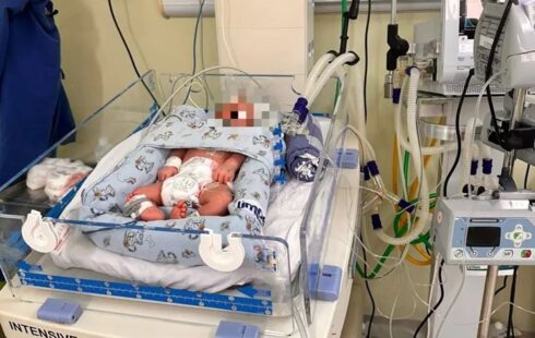 Tratamento que resfria o corpo para proteger o cérebro é aplicado em bebê no Amapá