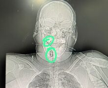 Grávida é baleada na cabeça e luta pela vida em Macapá