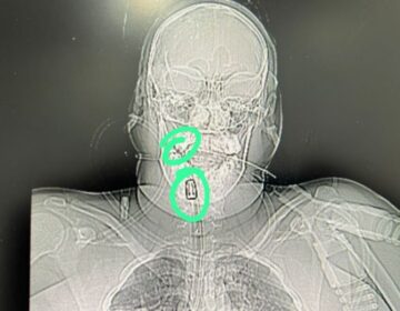 Grávida é baleada na cabeça e luta pela vida em Macapá